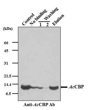 Chitin-binding ability of recombinant AcCBP. Recombinant AcCBP was incubated with chitin beads, followed by washing and elution. Protein samples from each fraction were analyzed using 12% SDS-PAGE and western blot analysis using anti-AcCBP antibodies. The AcCBP proteins are indicated