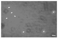 노제마병 사충으로부터 순수분리한 노제마의 위상차현미경 사진(X400). Scale bar, 10 um