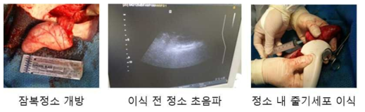 유도 잠복정소 내로의 세포이식 방법