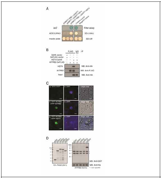 AtTRB2 interacts physically with the HD2-type histone deacetylase, HDT4, in vivo and in vitro> (A) Yeast two-hybrid assay showing direct interaction between AtTRB2 and HDT4 (left panel). (B) Analysis of AtTRB2 binding to HDT4 in plant cells determined by immunoblot. (C) Bimolecular fluorescence complementation (BiFC) analysis detected fluorescence signals generated by the interaction between AtTRB2 and HDT4 in tobacco epidermal cells (Nicotiana benthamiana). (D) In vitro pull-down assay showing the exclusive interaction of AtTRB2 with HDT4 among HD2 class histone deacetylases in Arabidopsis