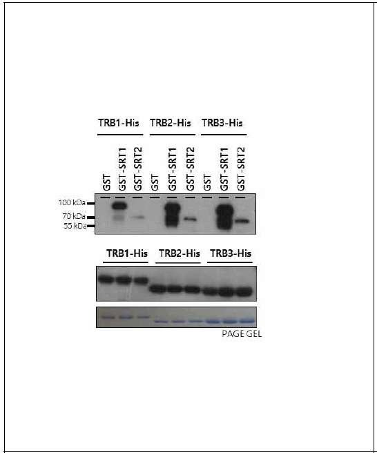 SRT1 and SRT2 directly interact with telomeric repeat binding proteins, AtTRB1, AtTRB2, and AtTRB3 in vitro