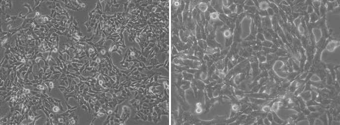 Morphology of growing chicken embryonic myoblast cells, pCM cells