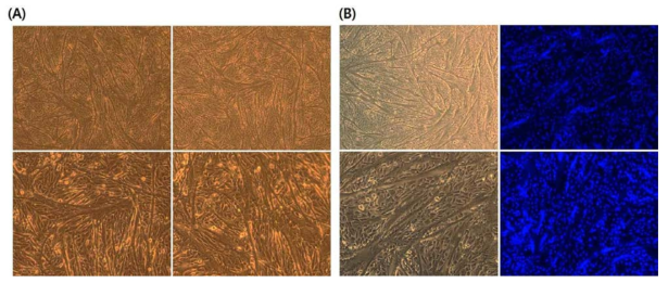 (A) Differentiated Foxo3 KD pCM cells into myotubes in the differentiation media for 4 days. (B) Detection of nucleus fusion in the differentiated myotubes of Foxo3 KD pCM cells with DAPI staining