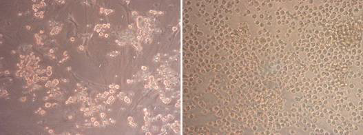 Primarily cultured Korean Oge primordial germ cells (PGCs) derived from embryonic gonads at 6days (left panel) and the established Korean Oge PGC line (right panel). (mgnification; 100x)