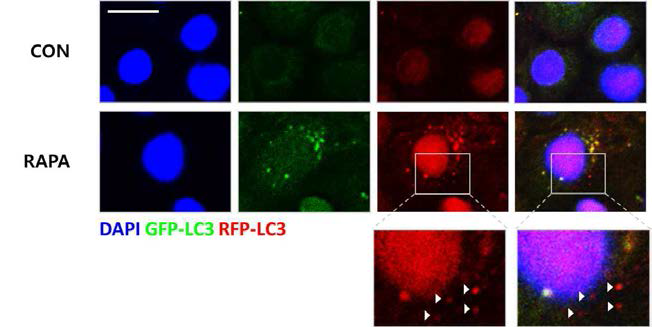 Rapamycin에 의한 돼지 장상피세포 내 autophagolysosome 유도