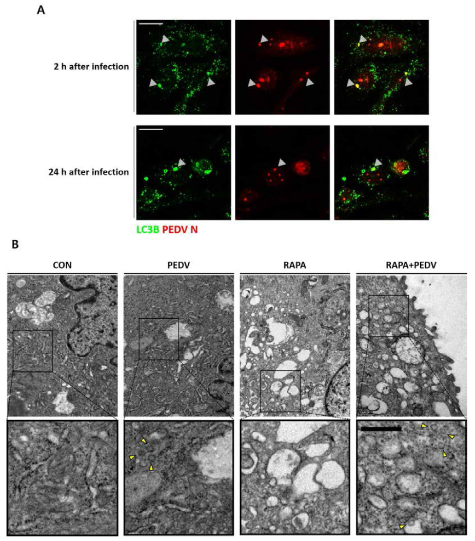 Autophagosome 내 PEDV