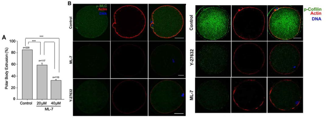 ML7과 Y-27632 처리 후 p-MLC와 p-Cofilin의 발현