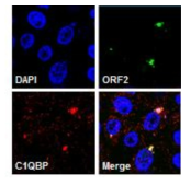 PCV2 ORF와 C1QBP 단백질의 상호작용을 confocal microscopy를 이용하여 확인한 결과