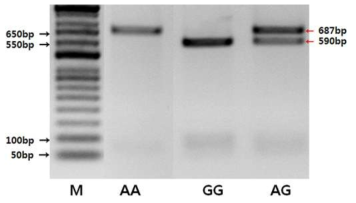 RGS16 SNP2의 유전자형에 따른 RFLP 밴드패턴