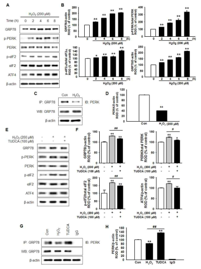 GRP78과 PERK 분해억제를 통한 소포체스트레스 감소