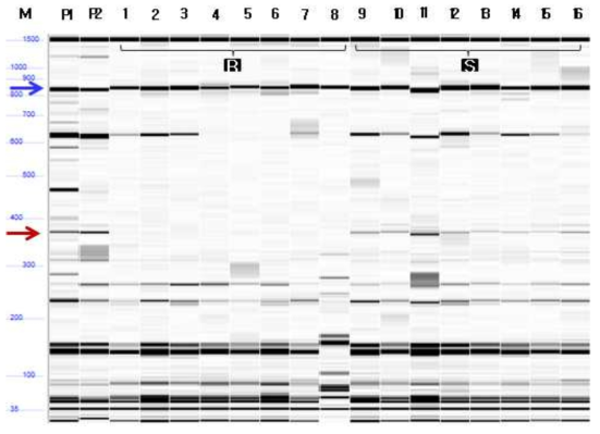 CMV-P1 RT-PCR 결과