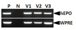 RT-PCR analysis of the hEPO and neomycin resistant gene in viral RNA. Lane P, plasmid DNA (pFIV-Ov19p-hEPOW) as positive control; lane N, negative control; lane V1, V2 and V3, FIV-Ov19p-hEPOW virus