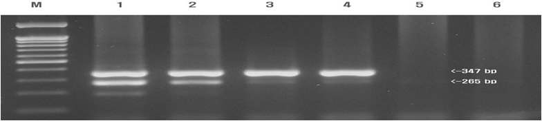 The sensitivity of duplex RT-nested PCR method. A mixture of 105 PCV2-infected PK15 cells/ml and 105.5 TCID50/ml PRRSV was 10-fold diluted. The limited detection of duplex RT-nested PCR was 101.5TCID50/ml for PRRSV and 102 infected cells/ml for PCV2. 100bp DNA ladder (lane M), stock of mixture (lane 1), serial 10- fold dilution of the stock from 10-1 to 10-5 (lanes 2-6)