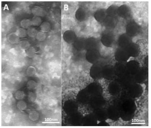 The transmission electron microscopic images of two selected phages. (A) DU_RP1B. Podoviridae with small size of head and very short tail. (B) DU_RP5B. Podoviridae with large size of head and very short tail.