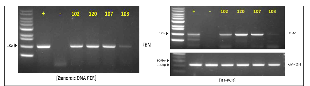 TBM 형질전환세포주 PCR 결과