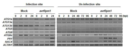 Pst DC3000 (avrRpm1)의 감염 및 비감염 조직에서 유전자 발현 분석