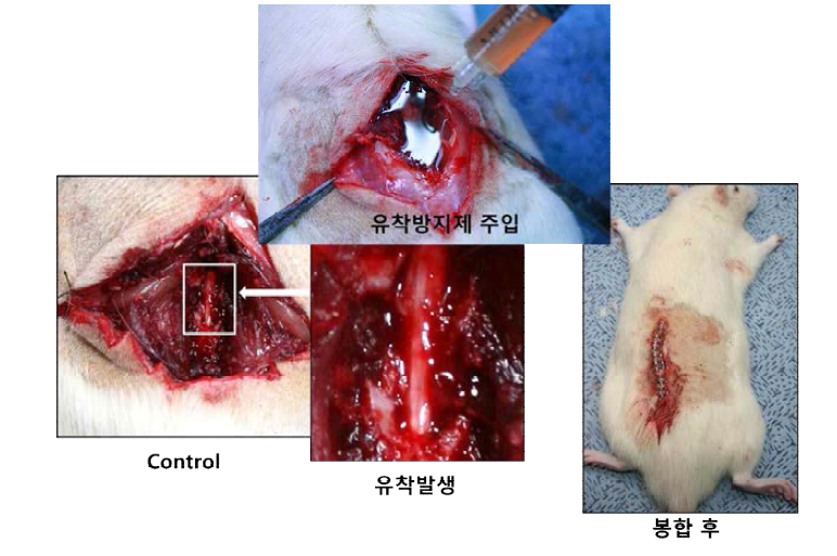 척추 수술 유착방지제 개발을 위한 동물 모델을 개발