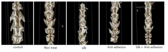 척추 유착방지 실험모델. X-ray 사진 결과