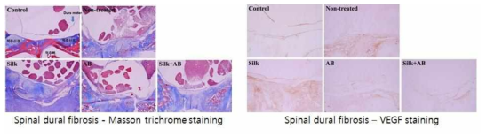 Masson trichrome staining , VEGF staining