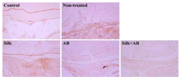 NF-kB Staining