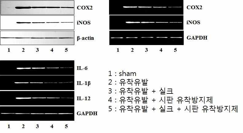 척추 수술 주변부위 염증 억제 기전 연구 Western Blot, RT-PCR