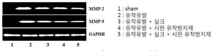 RT-PCR 결과