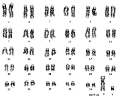 DT-A-RG1 bβCE3-GST-Factor Xa-mature IL-2-neo KI knock-in 세포주의 chromosome 분석