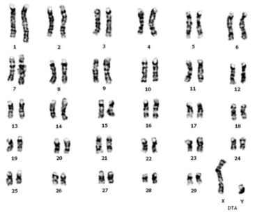 DT-A-RG1 bβCE3-GST-Factor Xa-mature KGF-neo KI knock-in 세포주의 chromosome 분석