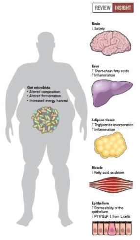Microbiota와 비만과 인과관계