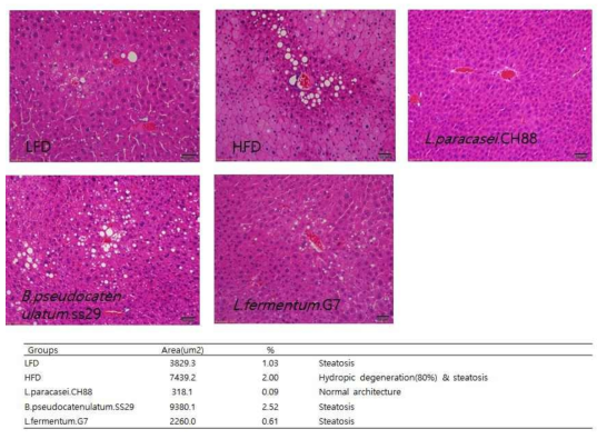 Effect of probiotics on liver stain