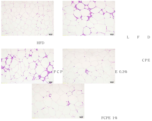 The morphology of epididymal adipose tissue. Sections of epididymal fat were stained with H&E. Magnification (×200)