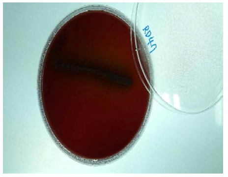 Bifidobacterium longum RD47