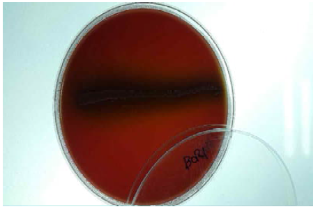 Bifidobacterium longum BORI