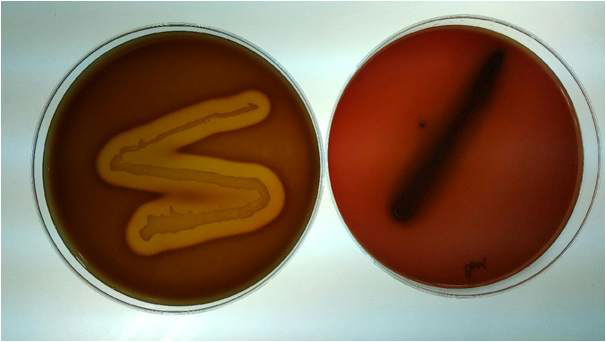 Listeria ivanovii subsp. ivanovii (ATCC 19119) and Bifidobacterium longum BORI