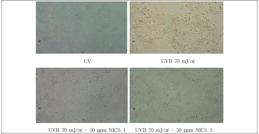 UV 보호 효능 세포 사진 (x200)