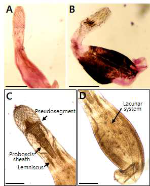 Two types (A, B) of acanthocephalan parasites collected from the Dybowskii’s brown frogs and the morphological characteristics of an Centrorhynchus acanthocephala (C, D). Bar=400 μm. Only two larvae in B plate type were found and excluded in further analysis