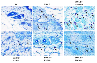 DNCB로 유도된 아토피 동물모델에서 봉독처리 후 mast cell의 변화 관찰