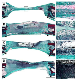 Histologic view of the generated bone after implantation for 1 weeks. Arrow head; defect marginal site, asterisk; FB residue, A; Blank, B; only fibrin scaffold (FB), C; P. ginseng 100 mg/ml + fibrin scaffold (GF 100), D; P. ginseng 300 mg/ml + fibrin scaffold (GF 300). Goldner’s trichrome stain Scale bar = 500 μm and 50 μm (inset)