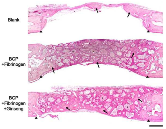 Hematoxylin and eosin-stained histological morphology of the entire area of calvarial defects at 4 weeks after implantation into rabbit calvarial defect model