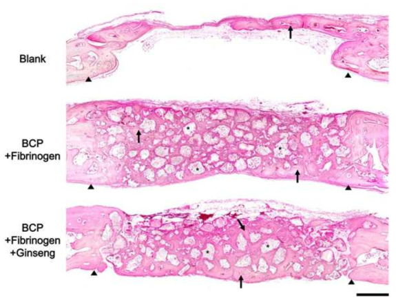 Hematoxylin and eosin-stained histological morphology of the entire area of calvarial defects at 8 weeks after implantation into rabbit calvarial defect model