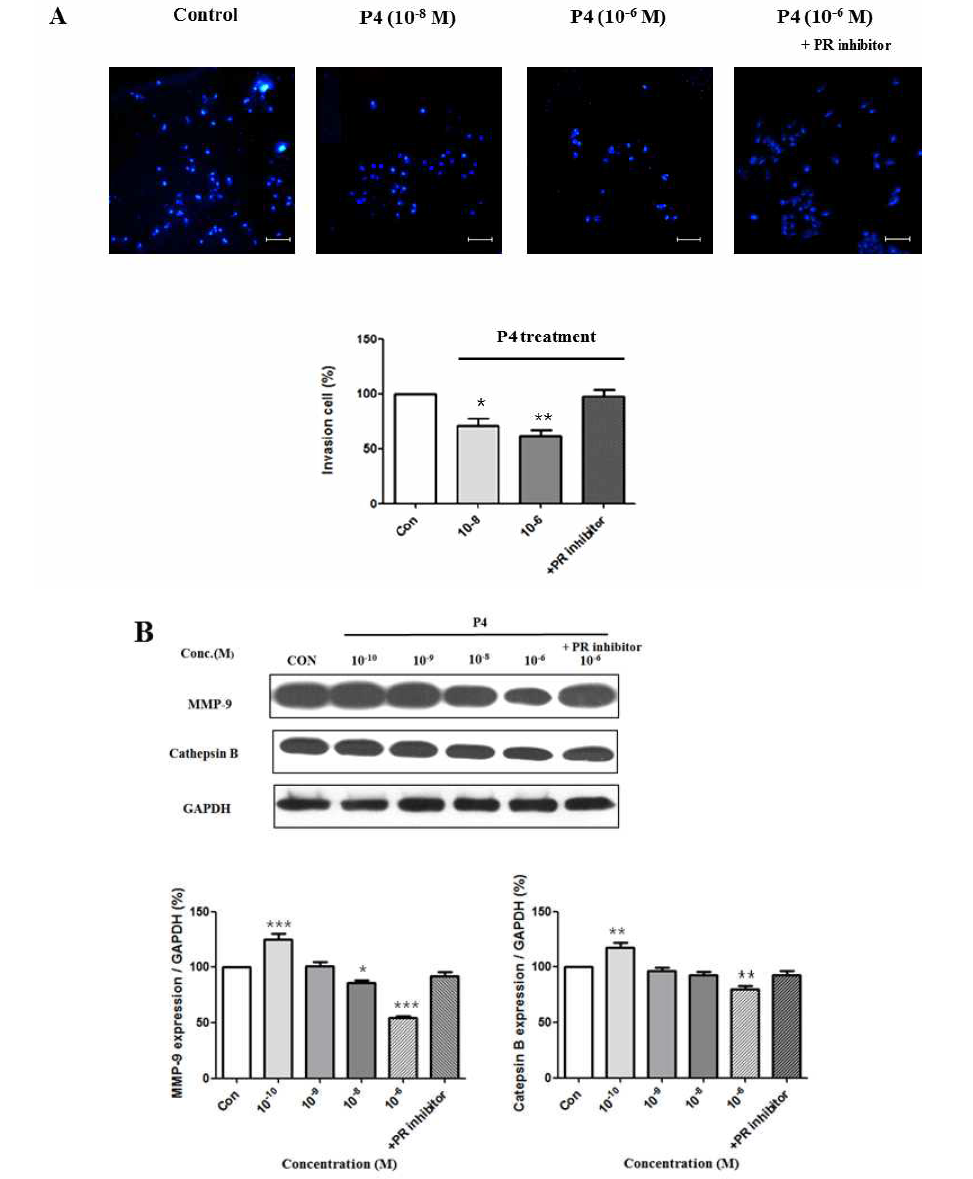 MCF-7 CV 세포에서 E2와 P4의 복합 처리에 따른 세포 침투성 변화 및 전이 관련 단백질 발현 변화