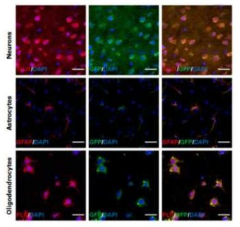 In vivo differentiation of human induced neural stem cells