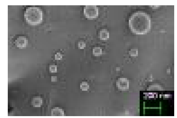 FE-SEM 50.0K에서의 lysosome 확인 사진