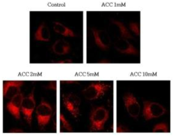 ACC 처리 농도에 따른 Hela cell 내의 Lysosome의 활성 변화