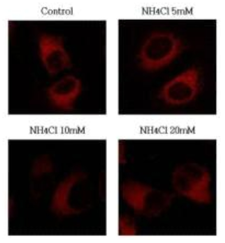 NH4Cl 처리 농도에 따른 Hela cell 내의 Lysosome의 활성 변화