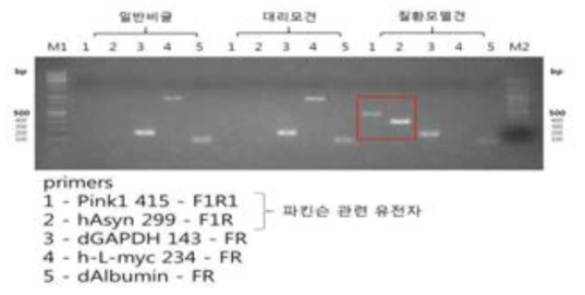 파킨슨 돌연변이 유전자 primer를 이용한 PCR 결과