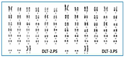 DLT-2.PS, DLT-3.PS 핵형 분석