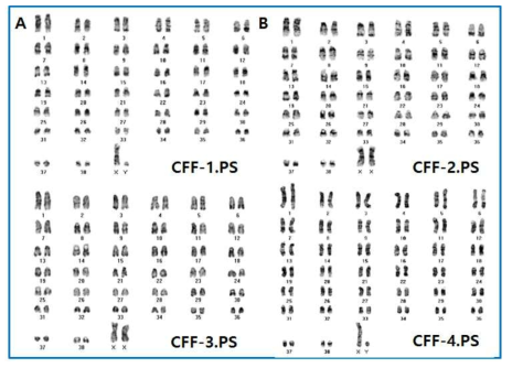 CFF.PS세포에서 핵형 분석