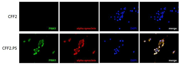 CFF2, CFF2.PS 섬유아세포에서 PINK1 및α-synuclein 단백질 발현을 면역형광염색법으로 분석