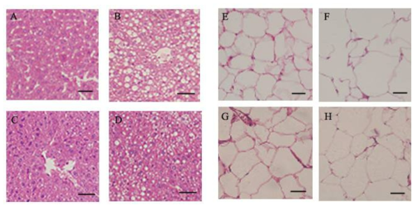 Morpholoogy changes in liver (A - D) and epididymal adipose tissue (E - H) for the male C57BL/6 mice. A - D, Oil Red O was used to stain livers sections of mice; E - H, H B and F, HFD (high fat/choleserol diet) ; C and G, HFD-MFRF (HFD plus 5 g/㎏ fravonoid rich fraction of mulberry leaf diet), D and H, HFD-MPA (HFD plus 5 g/㎏ purified anthocyanin fraction of mulberry fruits diet). scale bar, 5 ㎛